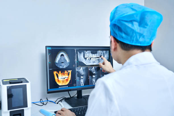 Best Emergency Tooth Extraction in Oakton, VA